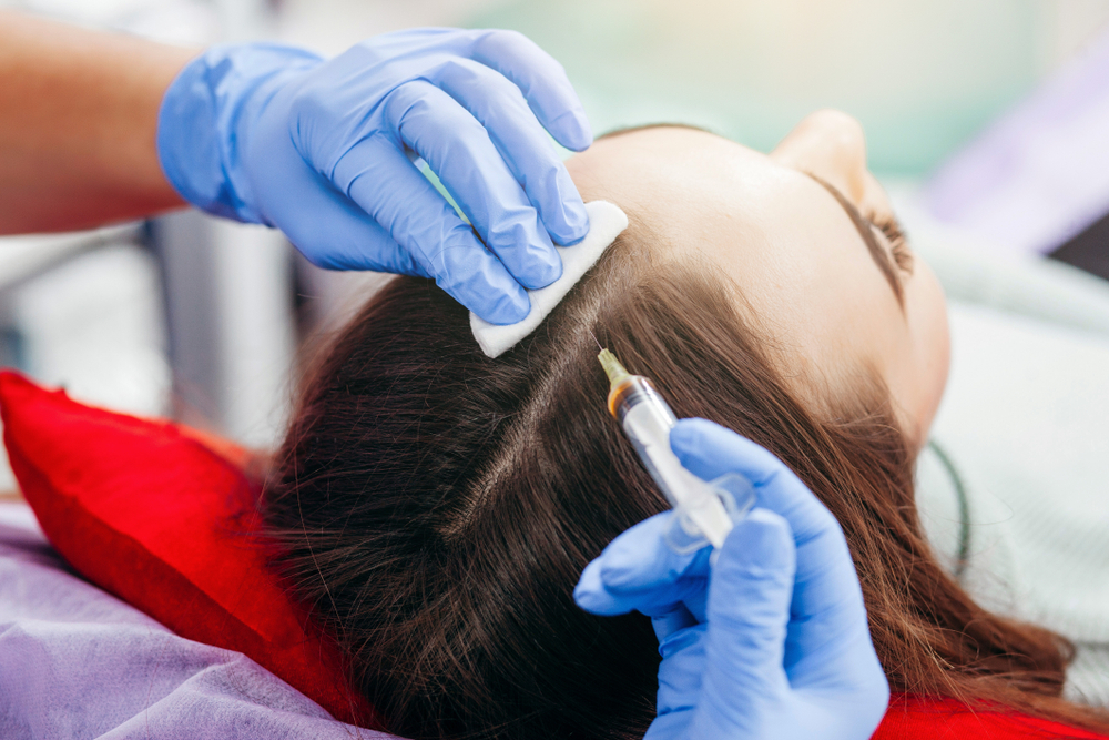 Everything there is to know about hair PRP therapy